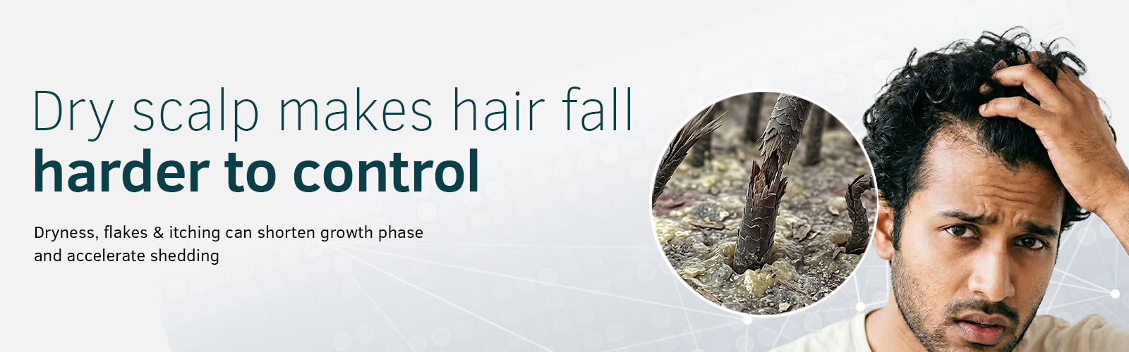 Dry Scalp Banner 1