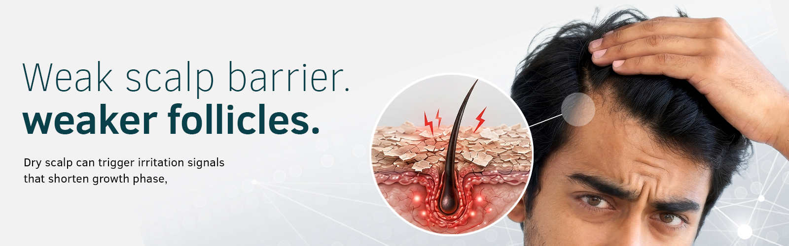 Dry Scalp Banner 2