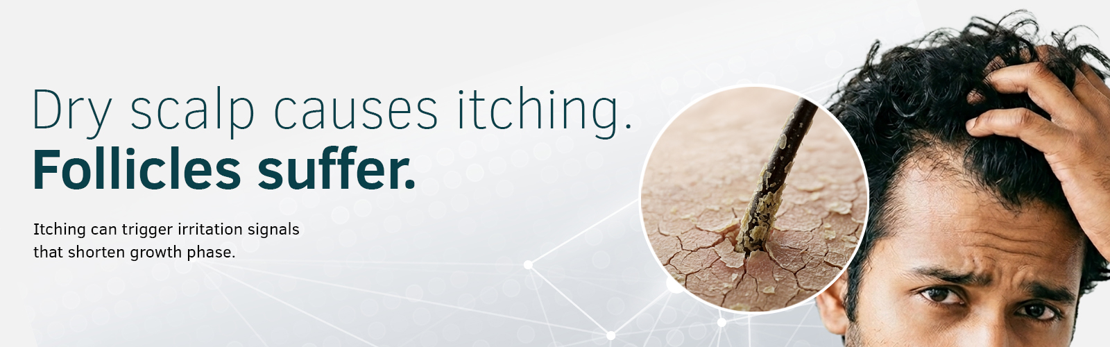 Dry Scalp Banner 3