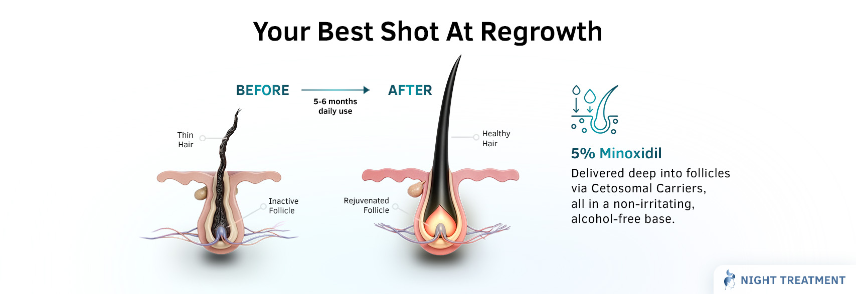 Benefits of Foligen Minoxidil 5% Hair Re-Growth Topical Solution