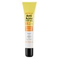 Category of Anti Acne