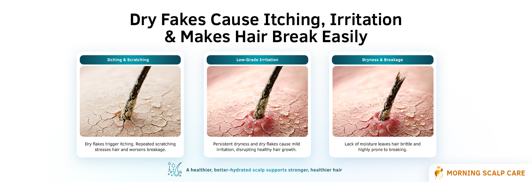Benefits of H-Grow Dry Scalp Shampoo | Fights Dry Flakes