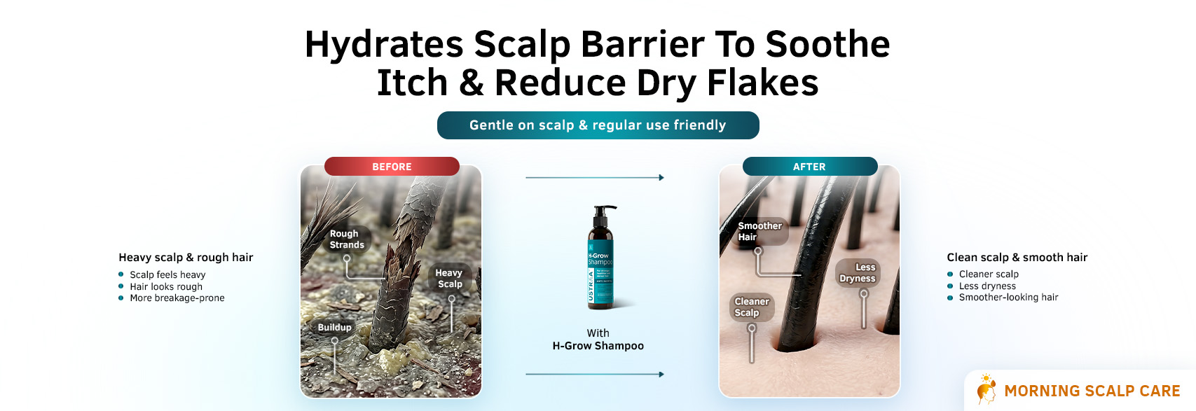 Benefits of H-Grow Anti Hairfall Shampoo | Biotin + Keratin