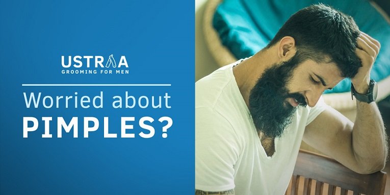 blog of 5 Skin care tips to control Acne/Pimples